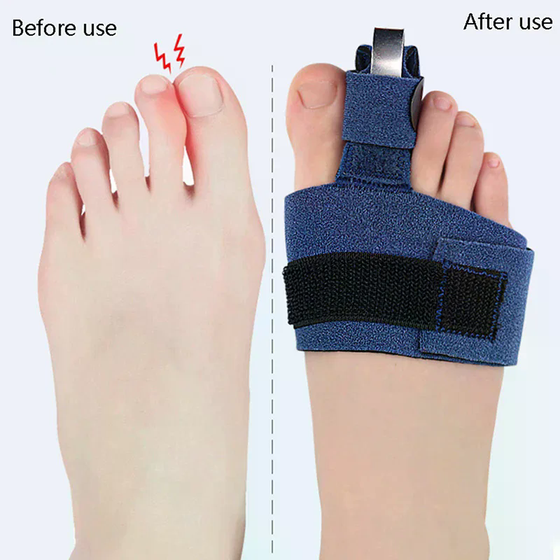 1Pcs Toe Corrector Toe Fractur – Ankle Brace Sock Bewertung und Preis